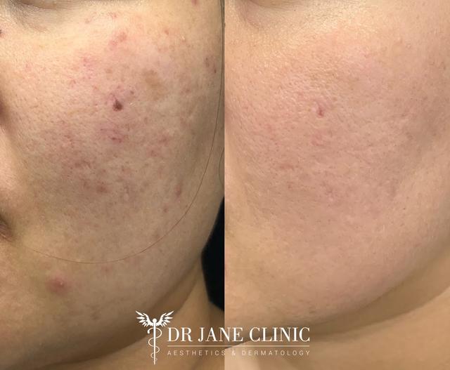 Photo of DR JANE CLINIC - Aesthetic Laser & Skin Clinic - Petaling Jaya, Selangor, Malaysia