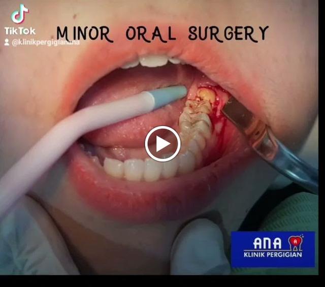 Photo of Klinik Pergigian Ana Shah Alam - Shah Alam, Selangor, Malaysia