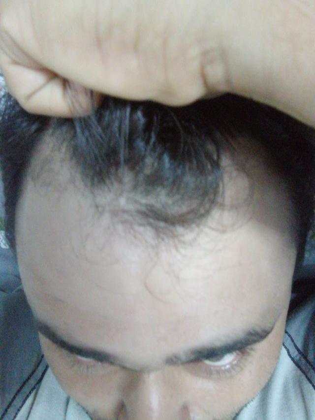 Photo of Nathan's Skin, Hair & Laser Centre - Kuala Lumpur, Kuala lumpur, Malaysia