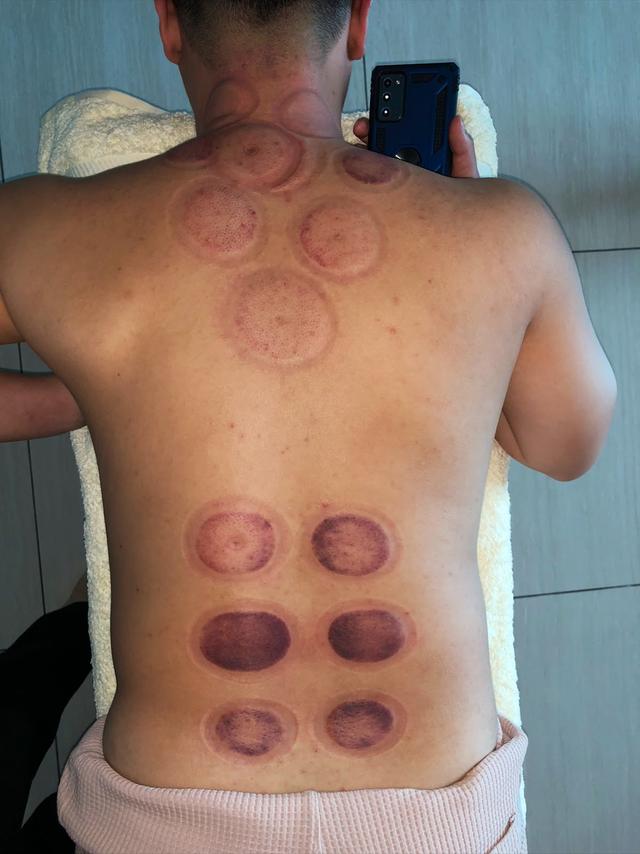 Photo of Philip Yap Physiotherapy Penang - Ayer Itam, Penang, Malaysia