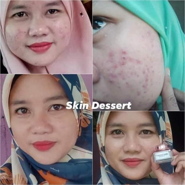 Photo of SKIN DESSERT DAN NURFELLA BEAUTY SHAH ALAM - Subang Jaya, Selangor, Malaysia