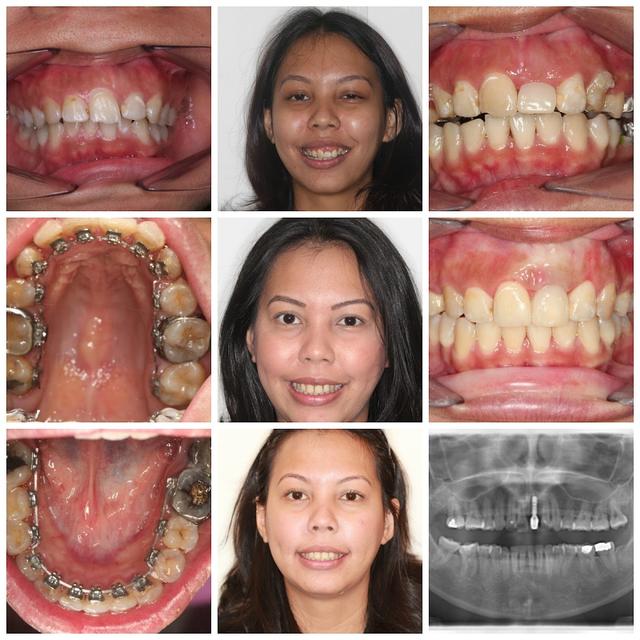 Photo of White Smile Dental Clinic - Kuala Lumpur, Kuala lumpur, Malaysia