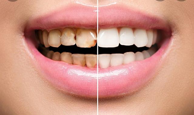 Photo of KLINIK PERGIGIAN GEETHAMARY N FERNANDEZ - Klang, Selangor, Malaysia